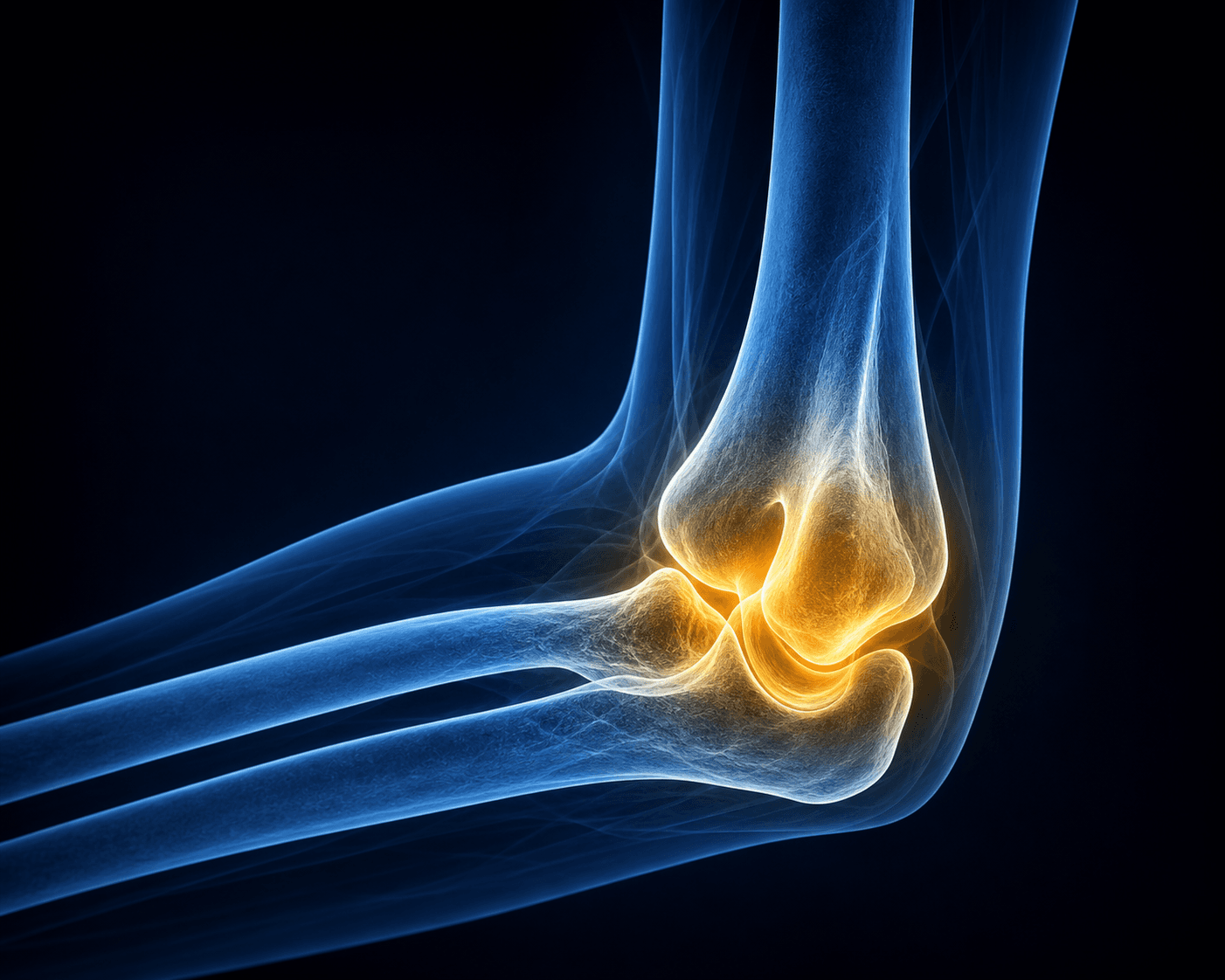 Elbow specialty visual